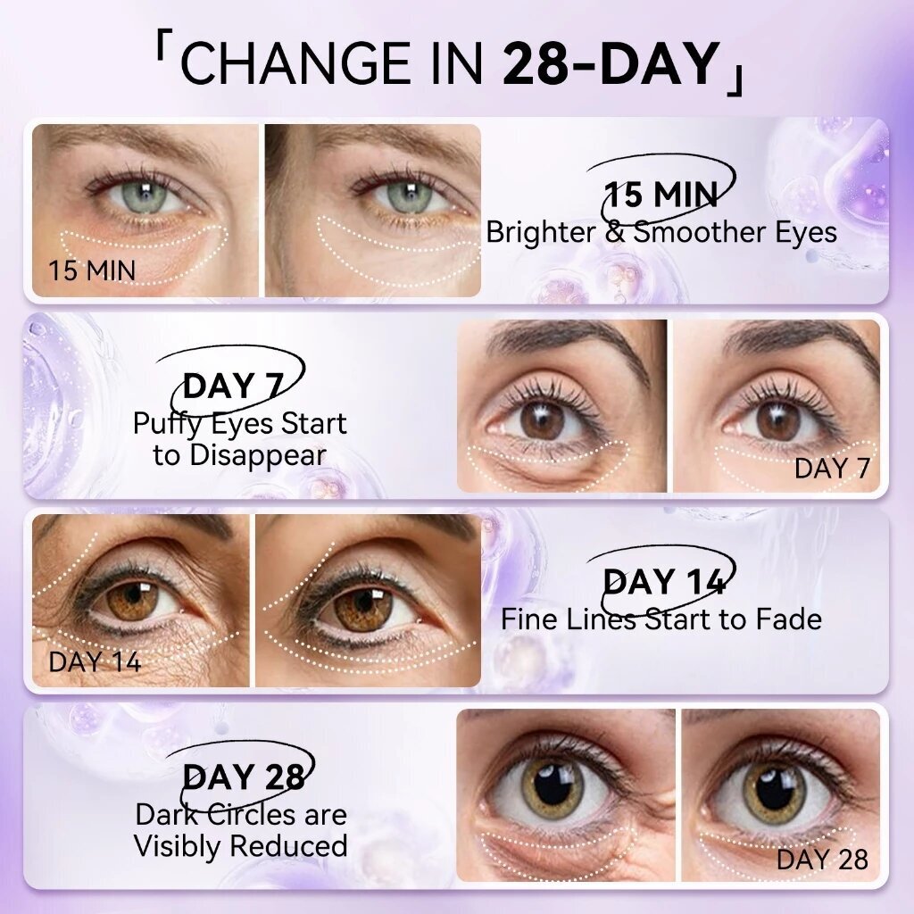 LANBENA Retinol Anti-Wrinkle E - Microneedle Patch Eye ulasan dan harga