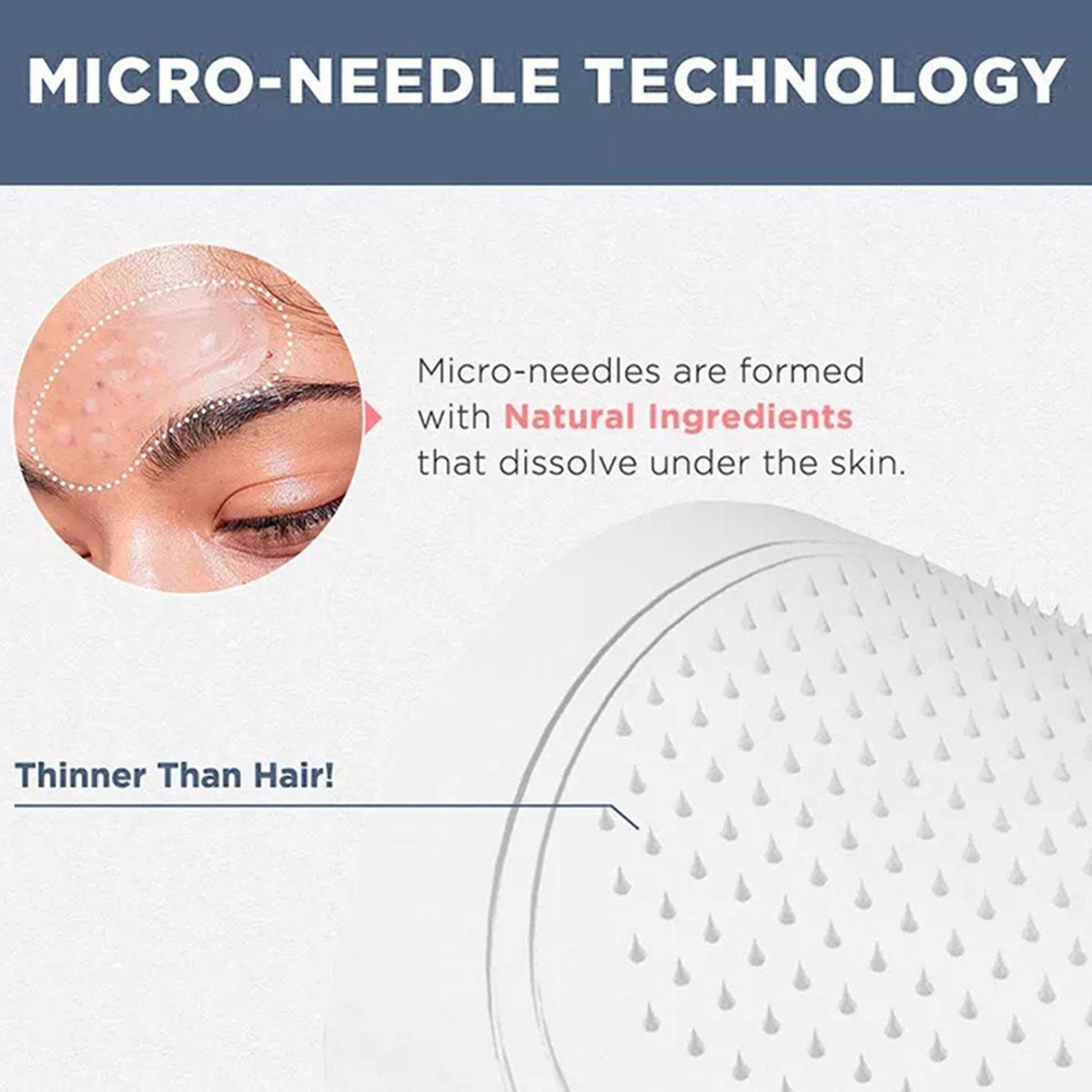 0.2mm Micro-needle Eye Patch M - Microneedle Patch Eye ulasan dan harga